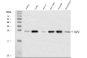 Western blot analysis of Aquaporin 2 using anti-Aquaporin 2 antibody (ABIN3043788). (AQP2 anticorps  (C-Term))