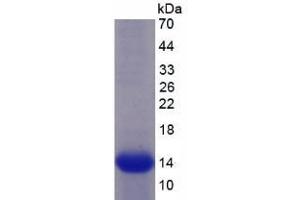 Image no. 1 for Sema Domain, Seven Thrombospondin Repeats (Type 1 and Type 1-Like), Transmembrane Domain (TM) and Short Cytoplasmic Domain, (Semaphorin) 5B (SEMA5B) (AA 36-161) protein (His tag) (ABIN1099448) (SEMA5B Protein (AA 36-161) (His tag))