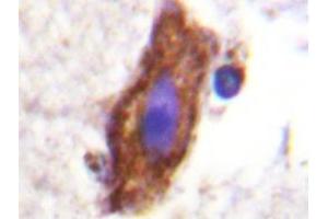 Immunohistochemistry analyzes of AP20219PU-N CSFR antibody in paraffin-embedded human brain tissue. (CSF1R anticorps)