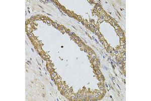 Immunohistochemistry of paraffin-embedded human prostate using PIK3CA antibody. (PIK3CA anticorps)