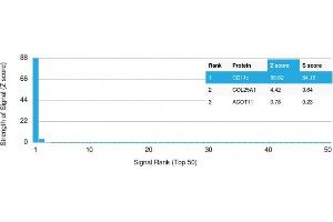 Analysis of Protein Array containing >19,000 full-length human proteins using CD11c Mouse Monoclonal Antibody (ITGAX/2507) Z- and S- Score: The Z-score represents the strength of a signal that a monoclonal antibody (Monoclonal Antibody) (in combination with a fluorescently-tagged anti-IgG secondary antibody) produces when binding to a particular protein on the HuProtTM array. (CD11c anticorps  (AA 637-827))