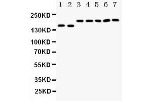 Anti-DCC antibody, Western blotting Lane 1: Rat Brain Tissue Lysate Lane 2: Mouse Brain Tissue Lysate Lane 3: U87 Cell Lysate Lane 4: SW620 Cell Lysate Lane 5: COLO320 Cell Lysate Lane 6: 293T Cell Lysate Lane 7: HELA Cell Lysate