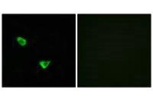 Immunofluorescence analysis of MCF-7 cells, using CHSS2 antibody. (CHPF anticorps)