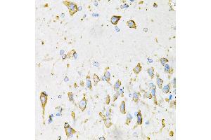 Immunohistochemistry of paraffin-embedded Mouse brain using ADIPOQ antibody (ABIN3016228, ABIN3016229, ABIN3016230 and ABIN6219638) at dilution of 1:100 (40x lens). (ADIPOQ anticorps  (AA 19-104))