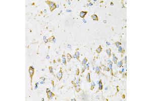 Immunohistochemistry of paraffin-embedded Mouse brain using ADIPOQ antibody (ABIN3016228, ABIN3016229, ABIN3016230 and ABIN6219638) at dilution of 1:100 (40x lens).