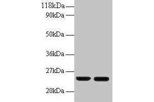 Western blot All lanes: RBP4 antibody at 2 μg/mL Lane 1: Human positive serum at 1: 10 Lane 2: Human positive serum at 1: 100 Secondary Goat polyclonal to rabbit IgG at 1/50000 dilution Predicted band size: 24 kDa Observed band size: 24 kDa