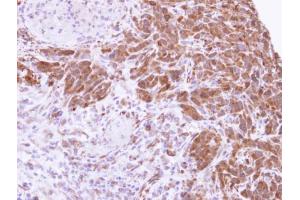 IHC-P Image Immunohistochemical analysis of paraffin-embedded SAS xenograft , using MTAP, antibody at 1:500 dilution.