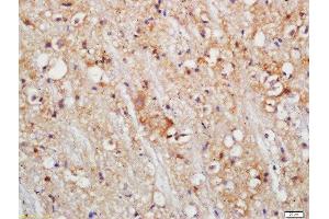 Formalin-fixed and paraffin embedded mouse brain labeled with Rabbit Anti-PLDL1 Polyclonal Antibody, Unconjugated (ABIN754588) at 1:200 followed by conjugation to the secondary antibody and DAB staining (PLCL1 anticorps  (AA 1001-1096))