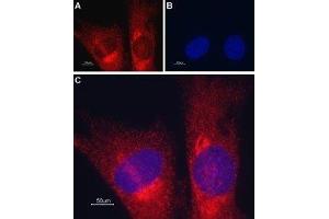 Expression of TRIC-A in mouse muscle myoblast (C2C12) cell line - Immunocytochemical staining of mouse paraformaldehyde-fixed and permeabilized muscle myoblast (C2C12) cell line.
