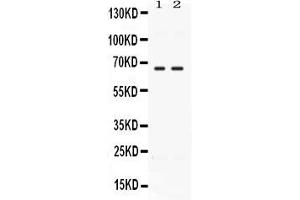 Western blot analysis of CCDC6 expression in rat testis extract ( Lane 1) and MCF-7 whole cell lysates ( Lane 2).
