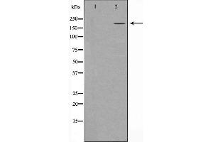 Western blot analysis of extracts of A431 , using TP53BP1 antibody. (TP53BP1 anticorps  (N-Term))