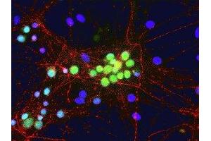 Immunofluorescence of cultured rat neurons showing nuclear and distal cytoplasmic staining of FOX1 in green. (A2BP1 anticorps  (N-Term))