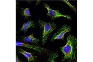 Image no. 2 for anti-B-Cell CLL/lymphoma 2 (BCL2) (AA 54-58) antibody (ABIN197202) (Bcl-2 anticorps  (AA 54-58))