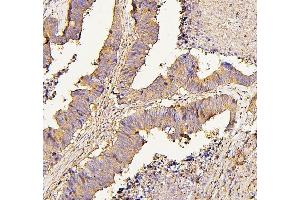 IHC analysis of NMI using anti-NMI antibody (ABIN6719489).