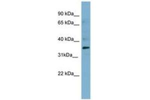 Image no. 2 for anti-Mesothelin (MSLN) (AA 395-444) antibody (ABIN6741693) (Mesothelin anticorps  (AA 395-444))