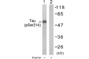 Image no. 1 for anti-Microtubule-Associated Protein tau (MAPT) (pSer214) antibody (ABIN196804) (MAPT anticorps  (pSer214))