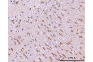 IHC analysis of RIMBP2 using anti-RIMBP2 antibody (ABIN7601441). (RIMBP2 anticorps  (AA 351-1049))