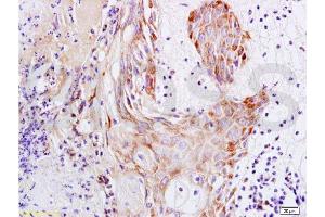 Formalin-fixed and paraffin embedded rat skin tissue labeled with Anti-S100A7 Polyclonal Antibody, Unconjugated at 1:200 followed by conjugation to the secondary antibody and DAB staining