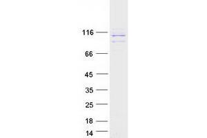 Validation with Western Blot