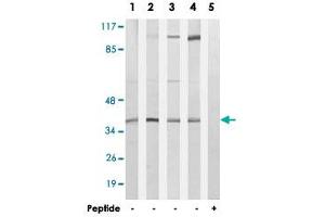 Western blot analysis of extracts from LoVo cells (Lane 1 and lane 5), A-549 cells (Lane 2), HUVEC cells (Lane 3) and MCF-7 cells (Lane 4), using HOXB2 polyclonal antibody . (HOXB2 anticorps)