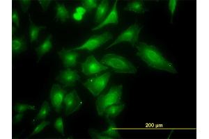Immunofluorescence of monoclonal antibody to TRAPPC4 on HeLa cell. (TRAPPC4 anticorps  (AA 1-219))