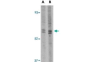 Western blot analysis of Trim30 in mouse heart tissue lysate with Trim30 polyclonal antibody  at (A) 1 and (B) 2 ug/mL . (TRIM30 anticorps  (N-Term))
