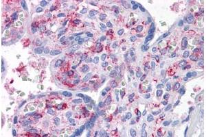 Human Placenta: Formalin-Fixed, Paraffin-Embedded (FFPE)