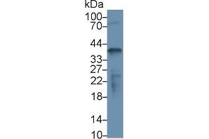 Detection of NPM1 in Human K562 cell lysate using Polyclonal Antibody to Nucleophosmin 1 (NPM1) (NPM1 anticorps  (AA 20-154))