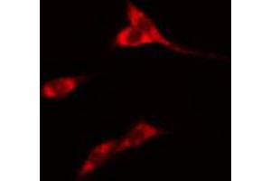 ABIN6274564 staining Hela cells by IF/ICC. (14-3-3 eta anticorps  (Internal Region))