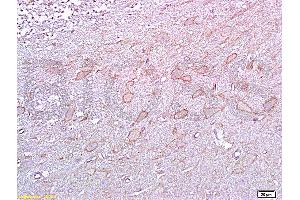 Formalin-fixed and paraffin embedded rat brain tissue labeled with :  Anti-5-HTR2A Polyclonal Antibody, unconjugated (ABIN737016)  at 1: 200 followed by incubation with conjugated secondary antibody and DAB staining (HTR2A anticorps  (AA 65-160))