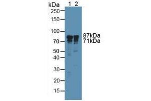 Western blot analysis of (1) Human A549 Cells and (2) Human Liver Tissue. (Integrin beta 3 anticorps  (AA 135-377))