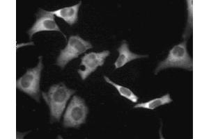 Immunofluorescent staining of A549 (ATCC CCL-185) cells. (CAMP-Dependent Protein Kinase R1 (PKA-R1) (AA 225-381) anticorps)