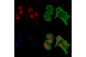 ABIN6256486 and ABIN6274031 staining Hela cells(heat shock treatment) by IF/ICC. (Histone H1.3 anticorps  (pThr18))