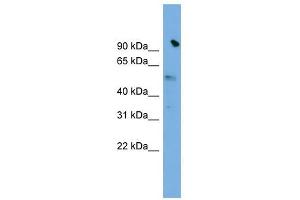SLC25A25 antibody used at 1 ug/ml to detect target protein. (SLC25A25 anticorps)