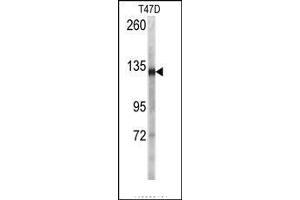 Image no. 1 for anti-Desmoglein 2 (DSG2) (N-Term) antibody (ABIN360106) (Desmoglein 2 anticorps  (N-Term))