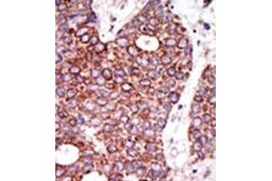 Image no. 2 for anti-Glucosaminyl (N-Acetyl) Transferase 1, Core 2 (GCNT1) (C-Term) antibody (ABIN357692) (GCNT1 anticorps  (C-Term))
