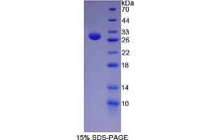 Image no. 1 for Hes Family bHLH Transcription Factor 1 (HES1) (AA 21-251) protein (His tag) (ABIN4990887)
