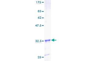 Image no. 1 for Translocase of Inner Mitochondrial Membrane 8A (TIMM8A) (AA 1-72) protein (GST tag) (ABIN1322777)