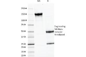 SDS-PAGE Analysis Purified LH-beta Mouse Monoclonal Antibody (LHb/1214). (LHB anticorps)