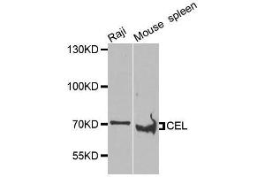 Western blot analysis of extracts of various cell lines, using CEL antibody.