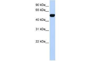 WB Suggested Anti-BTBD10 Antibody Titration:  0. (BTBD10 anticorps  (N-Term))