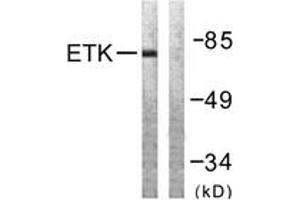 Western Blotting (WB) image for anti-BMX Non-Receptor Tyrosine Kinase (BMX) (AA 532-581) antibody (ABIN2888766) (BMX anticorps  (AA 532-581))