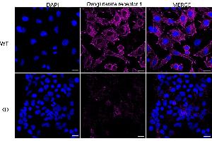 Immunocytochemical staining of HeLa cells using Oxoglutarate receptor 1 antibody (ABIN7799714), 1:1,000), Top panel: wild-type (WT), Bottom panal: Oxoglutarate receptor 1 shRNA knockdown (KD). (Recombinant OXGR1 anticorps)