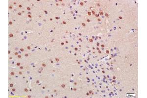 Formalin-fixed and paraffin embedded rat brain with labeled Anti-C9orf72 Polyclonal Antibody, Unconjugated (ABIN1386141) at 1:200, followed by conjugation to the secondary antibody and DAB staining