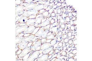 Immunohistochemistry of paraffin-embedded mouse kidney using Filamin A Rabbit mAb (ABIN1682545, ABIN3018024, ABIN3018025 and ABIN7101570) at dilution of 1:100 (40x lens). (Filamin A anticorps)