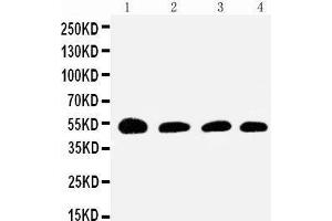 Anti-Antithrombin III antibody, Western blotting Lane 1: Rat Testis Tissue Lysate Lane 2: SMMC Cell Lysate Lane 3: JURKAT Cell Lysate Lane 4: RAJI Cell Lysate (SERPINC1 anticorps  (N-Term))