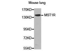 Western Blotting (WB) image for anti-Macrophage Stimulating 1 Receptor (C-Met-Related tyrosine Kinase) (MST1R) antibody (ABIN2650934) (MST1R anticorps)