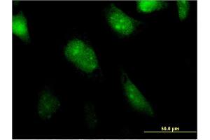 Immunofluorescence of monoclonal antibody to BATF2 on HeLa cell. (BATF2 anticorps  (AA 1-189))