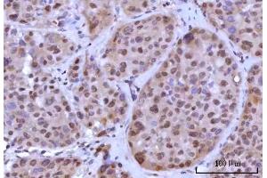 IHC analysis of RNF40 using anti-RNF40 antibody (ABIN7602723).