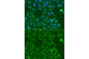Immunofluorescence analysis of A549 cell using SSX5 antibody. (SSX5 anticorps)